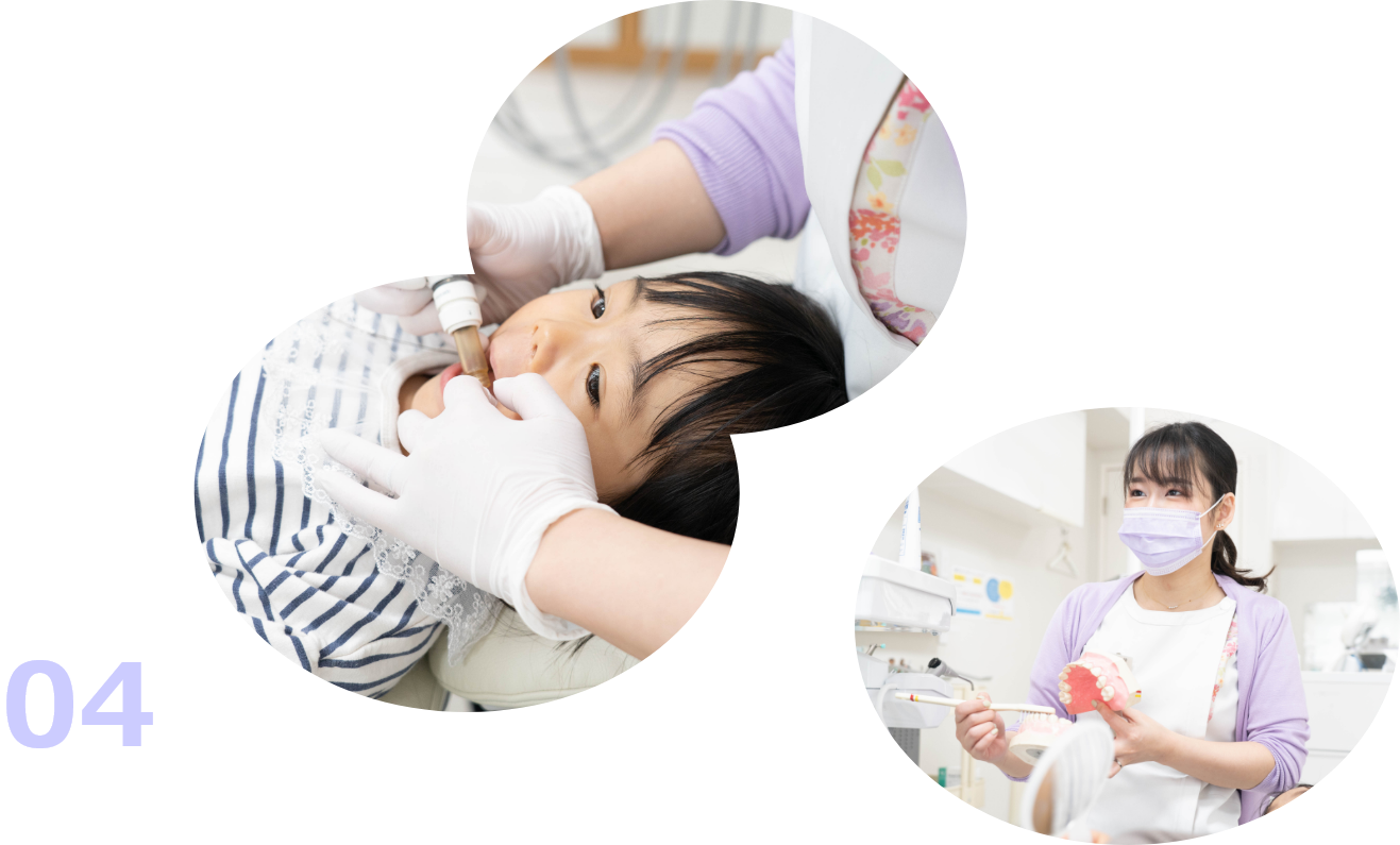 お子さまの年齢に合わせた定期検診・歯磨き指導